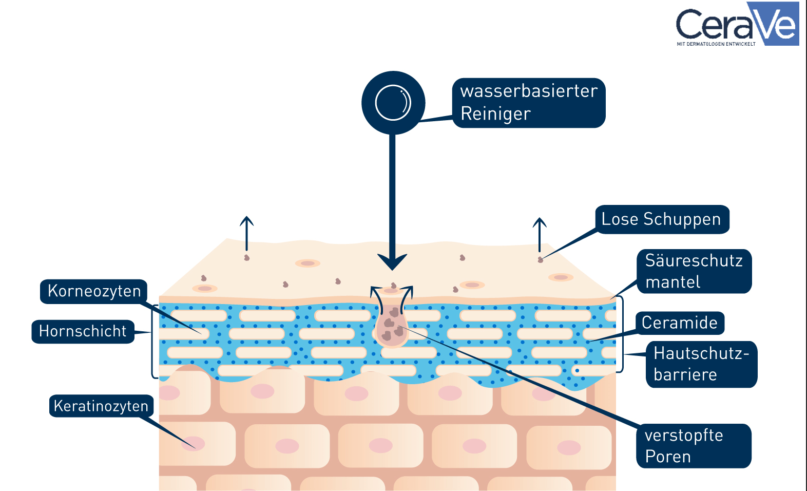 Graphique de la peau et du nettoyage à base d'eau lors du Double Cleansing